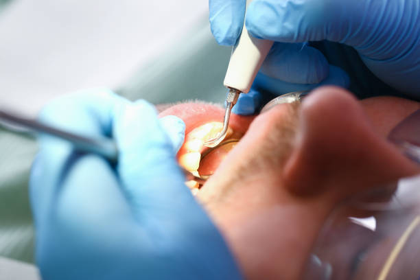 Best Weekend Emergency Dentist in Rancho Cordova, CA